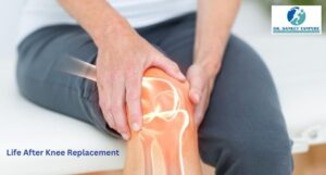 Life After Knee Replacement: Recovery, Mobility & Long-Term Care Guide