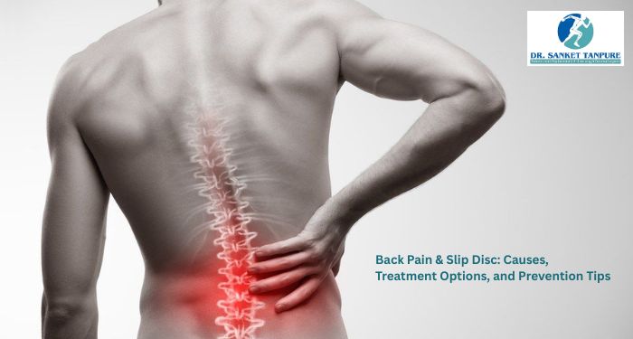 Learn about back pain and slip disc causes, symptoms, treatment options, and prevention tips. Consult an experienced Orthopedic Surgeon in Pimpri Chinchwad for expert care.