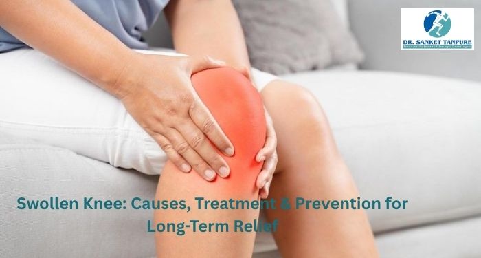 Swollen Knee Treatment by Dr Sanket Tanpure
