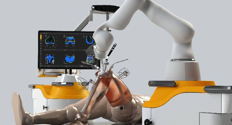 Robotic-Joint-Replacement1